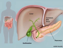 5 Tanda Kantong Empedu Bermasalah yang Sering Diabaikan, Waspada Sebelum Parah!