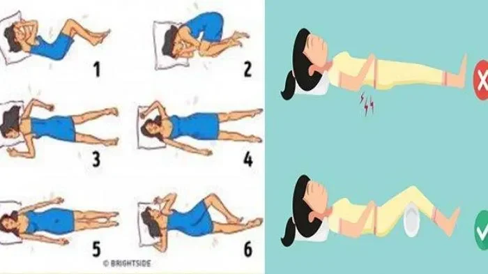 Ilustrasi posisi tidur, menunjukkan posisi yang disarankan dan dihindari untuk penderita GERD.