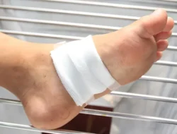 Kaki Diabetes Sering Luka Parah & Susah Sembuh? Ini Penyebabnya yang Wajib Kamu Tahu!