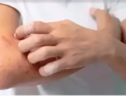 Kulit Gatal Tak Kunjung Hilang? Awas, Bisa Jadi Tanda 7 Penyakit Kronis dan Kanker yang Jarang Disadari!