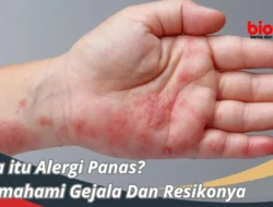 Terkuak! Ribuan Siswa Keracunan Massal Program Makan Gratis, Ini Bedanya dengan Alergi Makanan yang Wajib Kamu Tahu!