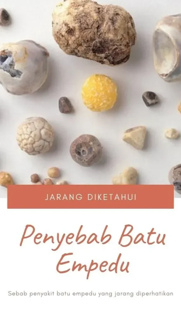 bikin ngeri 8 makanan enak ini ternyata musuh utama kantung empedu wajib dihindari portal berita terbaru