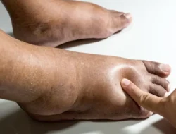 Bukan Cuma Nasi! 7 Kebiasaan Sepele Ini Diam-diam Bikin Kamu Kena Diabetes, Wajib Tahu!