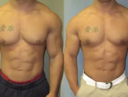 Dada Pria Membesar: Sekadar Lemak atau Tanda Bahaya Tersembunyi? Ini Fakta yang Wajib Kamu Tahu!