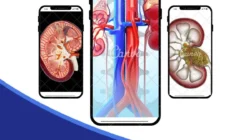 Jangan Anggap Remeh! Ini Tanda Ginjal Bocor yang Sering Diabaikan, Cek Sekarang! 2 jangan anggap remeh ini tanda ginjal bocor yang sering diabaikan cek sekarang portal berita terbaru