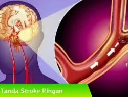 Kabar Mengejutkan! Kak Seto Dilarikan ke RS Akibat Stroke Ringan dan Aritmia, Begini Gejala Awal yang Wajib Diwaspadai 8 Kabar Mengejutkan! Kak Seto Dilarikan ke RS Akibat Stroke Ringan dan Aritmia, Begini Gejala Awal yang Wajib Diwaspadai