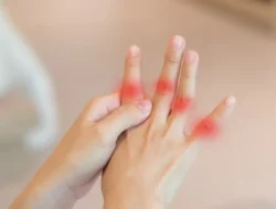 Bukan Cuma Jempol Kaki, Asam Urat Juga Bisa Serang Jari Tanganmu! Waspada Gejala dan Cara Mencegahnya