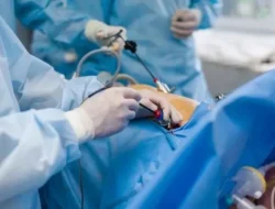 Fahmi Bo Akhirnya Dioperasi! Perjuangan Hidup Bintang Lupus Ini Bikin Haru