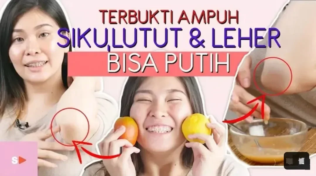 gak pede siku hitam ini 5 rahasia ampuh cerahkan kulit siku dalam hitungan minggu auto pd portal berita terbaru