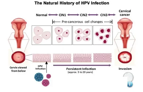 jangan anggap sepele 7 gejala kanker kolon onset dini yang kini intai anak muda portal berita terbaru