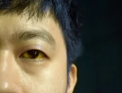 Mata Kuning Bukan Sekadar Lelah! Waspada, Ini 7 Penyakit Serius yang Mengintai Tubuhmu